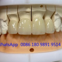 中国义齿实验室 假牙供应商 牙科生产厂家
