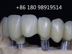 Dental lab in ShenChina深圳义齿加工厂