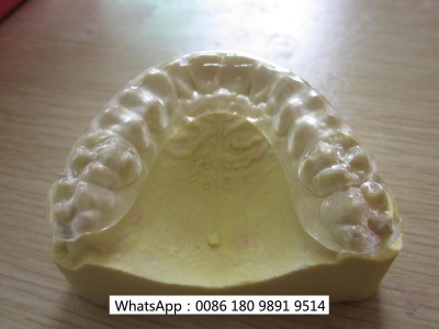 深圳隐形牙齿活动矫治器 透明矫正器 隐形矫治器个性化定制生产