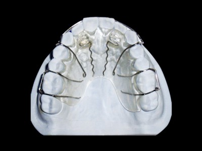 3D打印隐形正畸矫正器 隐形矫公司3D打印