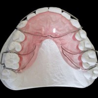 隐形矫治_MYY隐形牙齿矫正系统,矫正中心,隐形牙齿矫治器