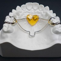 深圳隐形牙套生产商矫正器定制 3D打印牙齿模型