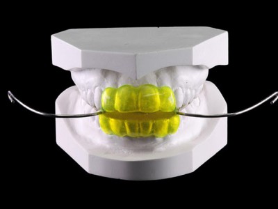 深圳义齿加工厂 固定义齿 3D 打印牙科矫正器出口