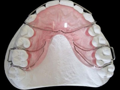 深圳定制式牙齿隐形正畸矫治器-3D隐形矫正-隐形牙套矫治图2