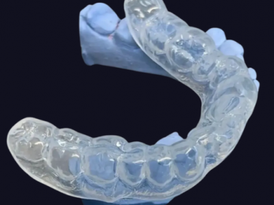 深圳定制式牙齿隐形正畸矫治器-3D隐形矫正-隐形牙套矫治图3
