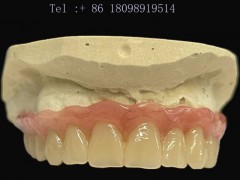 珠海义齿工厂 假牙厂家 认证FDA定制式固定义齿产品