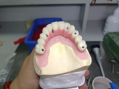 深圳种植牙Dental Implant外贸出口图3