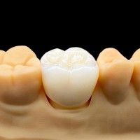 种植牙Dental Implant外贸出口