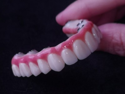 种植牙Dental Implant外贸出口图2