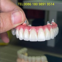 深圳国际假牙出口工厂义齿厂家外贸